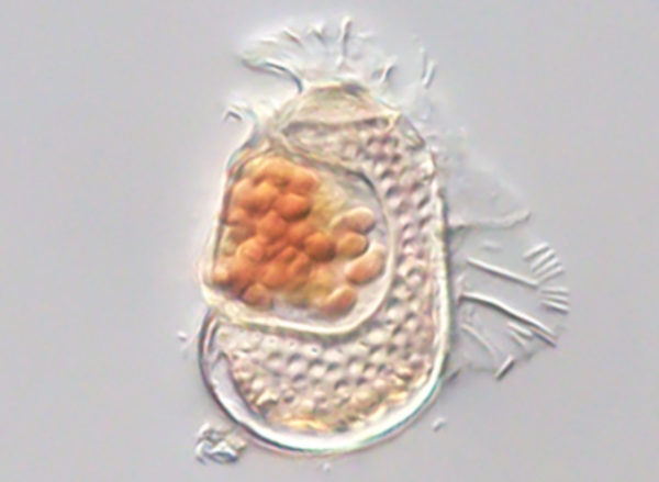 Within this dinoflagellate plankton is a tiny microbe that acts more like a virus than a cell. (Takuro Nakayama/University of Tsukuba)