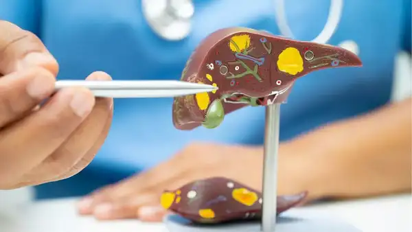 What is gallbladder cancer