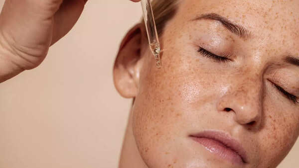 Acne (2)