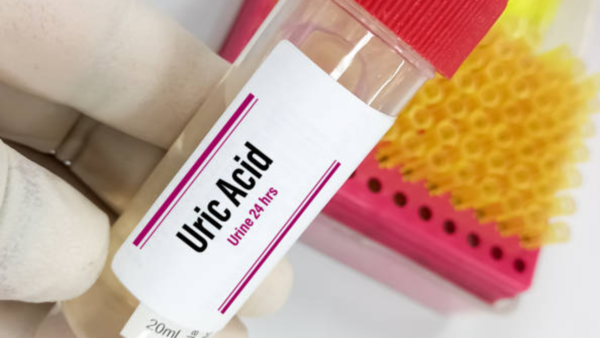 What is uric acid?