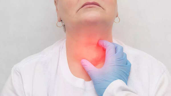Throat cancer: Signs and symptoms
