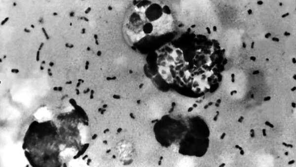 Plague (1)
