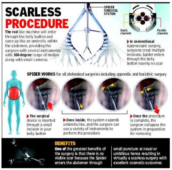 spider surgical system