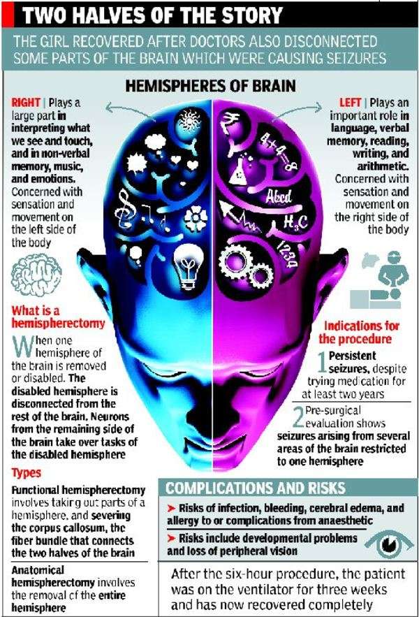 Doctors remove part of girl's brain to stop seizures | Chennai News ...