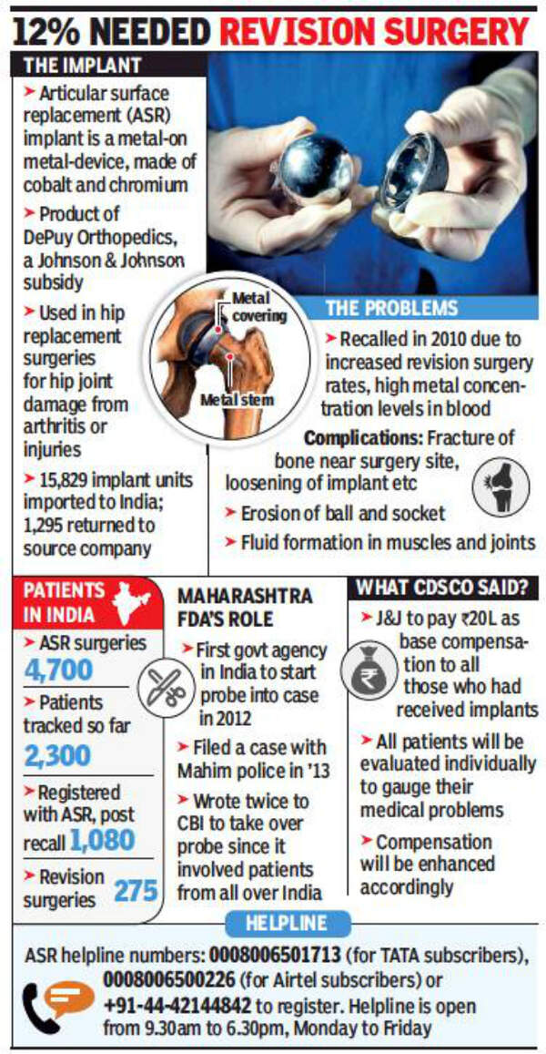 Johnson And Johnson Hip Replacement Lawsuit Half of Johnson & Johnson hip implant users unaware of defects | Mumbai