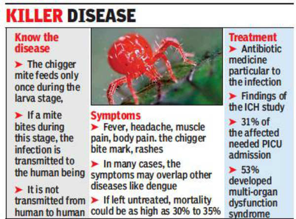 Scrub Typhus Cases Rising Scrub Typhus Cases In Kolkata And Fringes Worry Doctors Kolkata