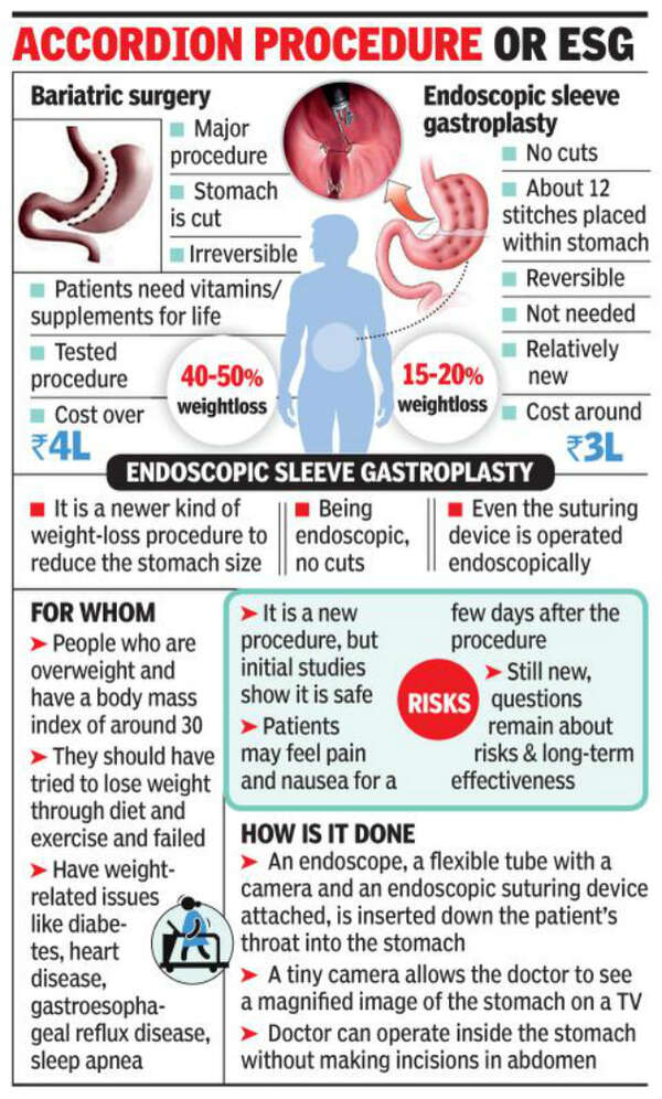 Weight loss with no cuts, but doctors not sure it’ll last Mumbai News Times of India