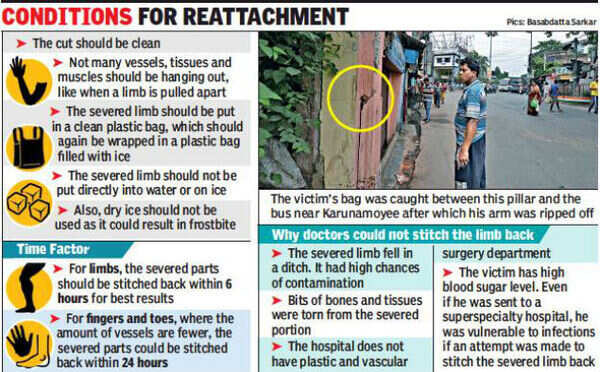 Kolkata: Passenger’s hand ripped off as bus grazes pillar | Kolkata ...