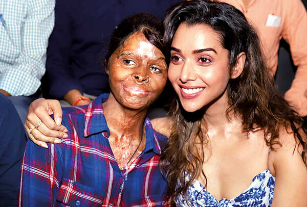 During her recent visit to the city actress Anupriya Goenka spent some time with the acid attack survivors who run a cafe in Gomti Nagar (BCCL/ Aditya Yadav)