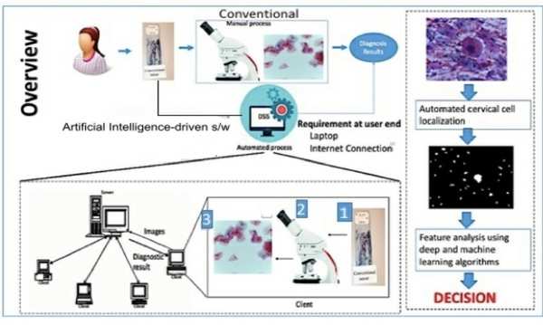 Indian Scientists Develop Software To Detect Cervical Cancer - Times Of ...