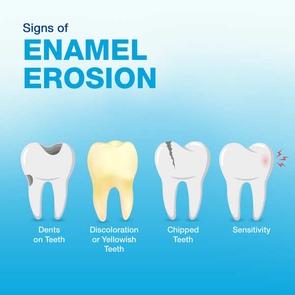 Is the silent shield of your teeth under attack? Enamel Erosion – Its ...