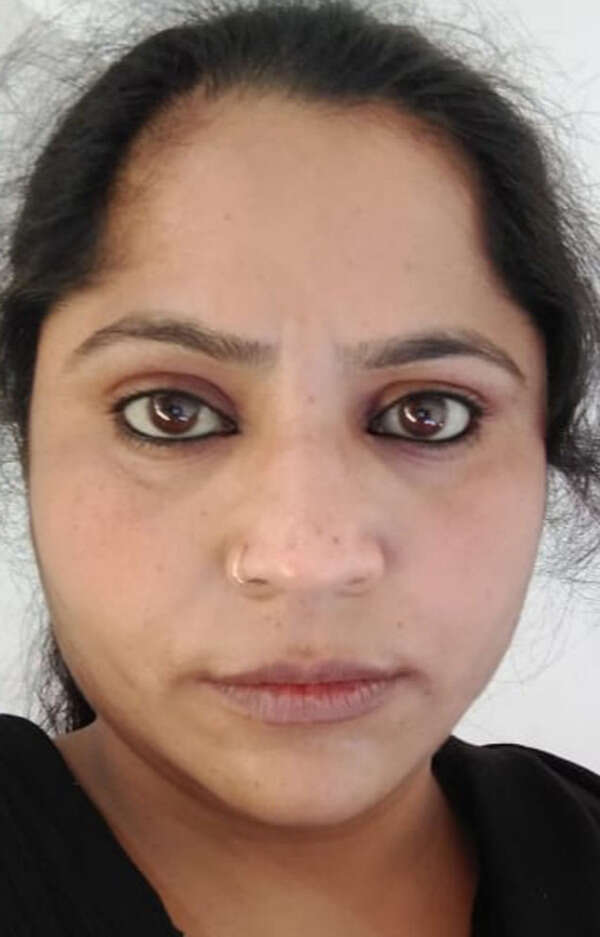 Ahmedabad: Three needles removed from woman’s body | Ahmedabad News ...