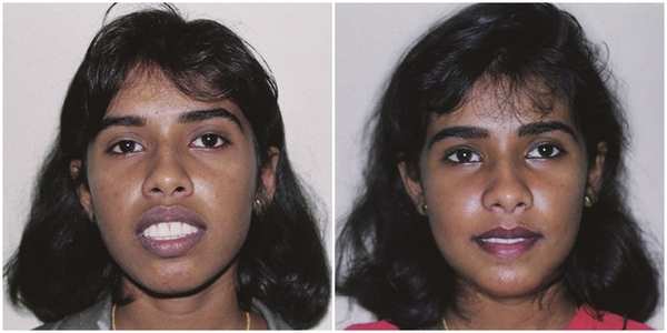 Balaji Dental & Craniofacial Hospital: Breakthrough in Maxillofacial ...