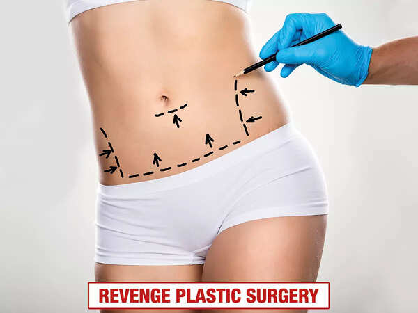 Revenge Plastic Surgery