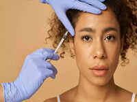 What to ask before going for a hair transplant: Do you really need one? Is your technician qualified? - Times of India What to ask before going for a hair transplant: Do you really need one? Is your technician qualified? - Times of India