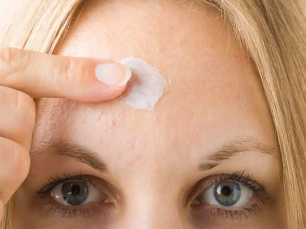 How to get rid of forehead acne