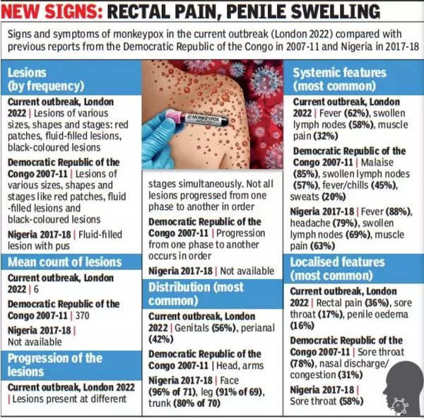 Symptoms of monkeypox differ from previous outbreaks