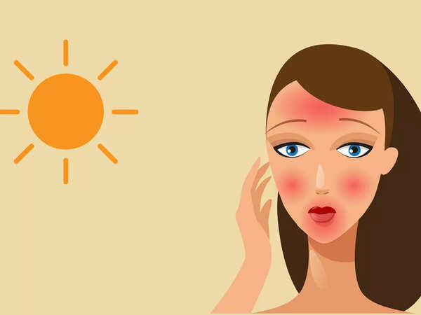 Woman's 'plastic' forehead after sun exposure shocks internet. Skin experts  share THESE warnings - Times of India