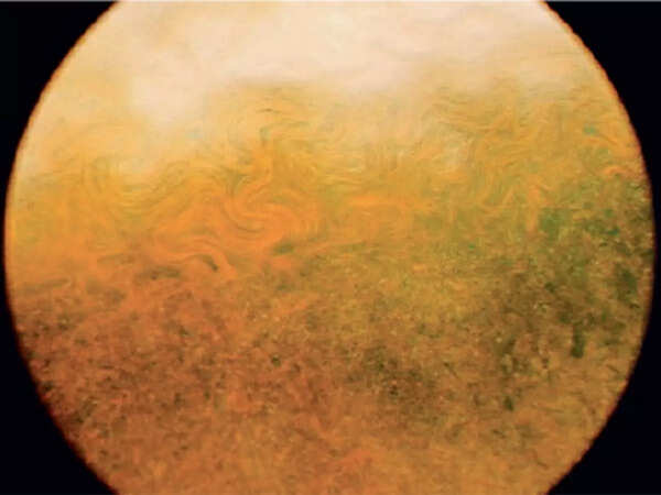 9 (3)