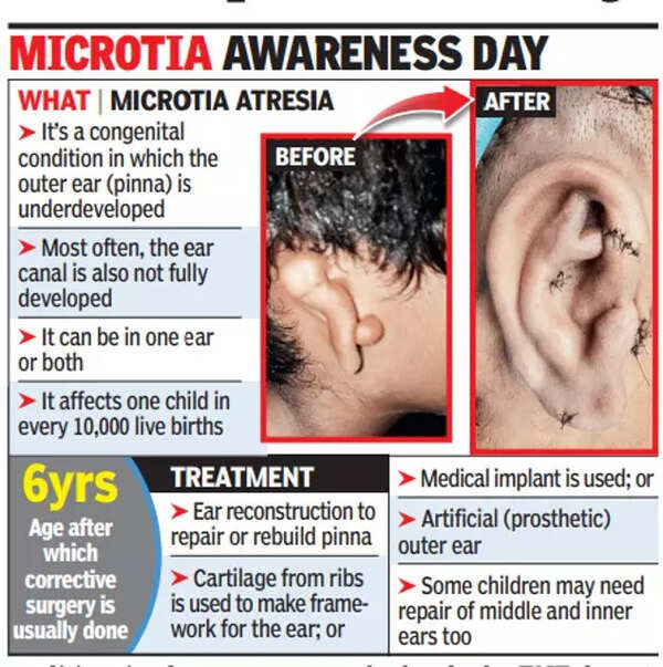 Teen s little ear hearing get fixed on special day mumbai news