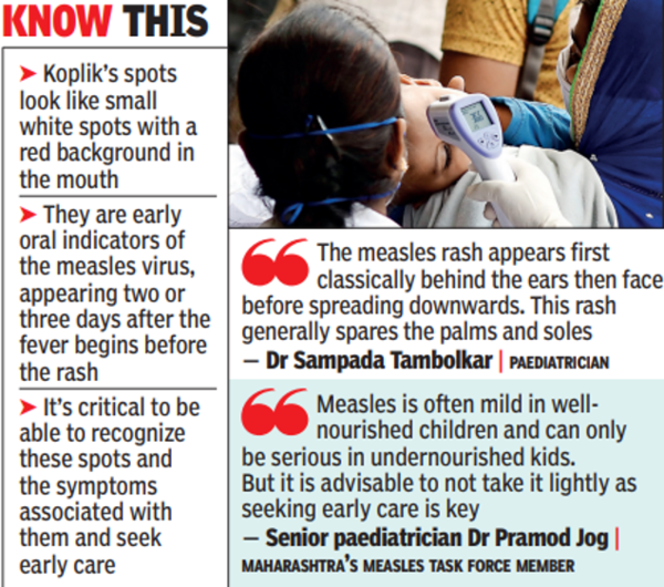 non-itchy-rash-and-tiny-white-spots-in-mouth-signs-of-measles-pune