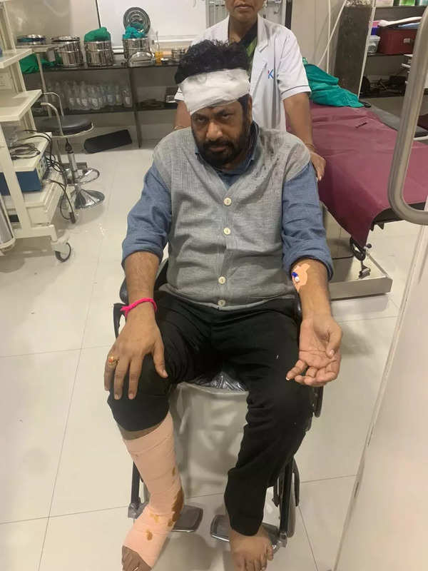 Maharashtra MLA Bacchu Kadu rushed to hospital after being hit by 2-wheeler in Amravati | Nagpur News – Times of India
