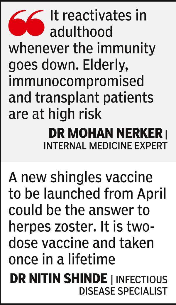 Herpes Zoster Infection Indicates Underlying Condition, Say Docs ...