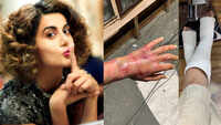 Here's the truth behind Taapsee Pannu's injured arm and plastered legs! 