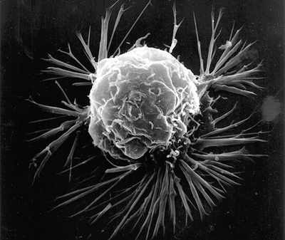 ‘Tails’ could detect possible cancers in the future
