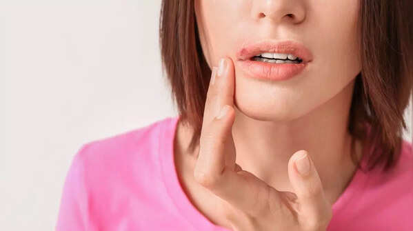 Sores that do not heal