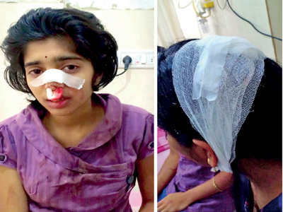 Auto driver breaks nose of 16-year-old for being nosey