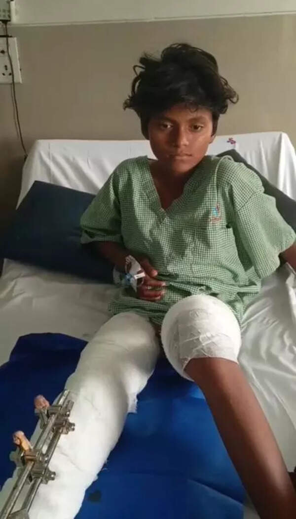 Techies of Hinjewadi rally to aid migrant child after road accident in Pune
