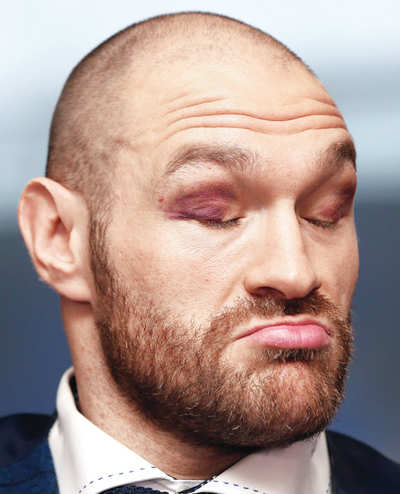 Fury’s foul-mouthed fightback against critics
