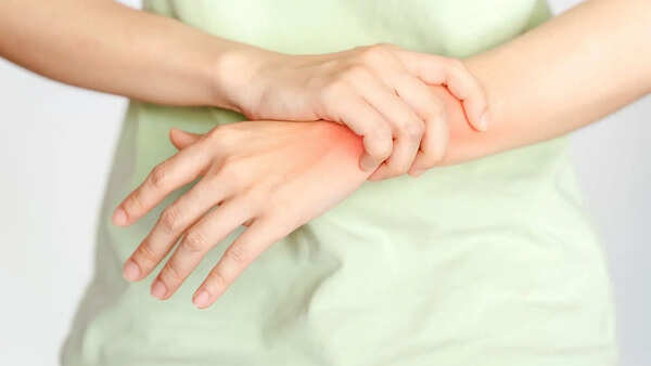 Think smoking only harms the heart and lungs? Doctor warns it may also trigger Rheumatoid Arthritis