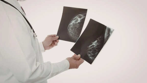 Mammograms are helping docs spot heart disease risk early