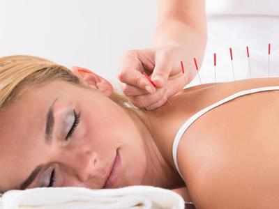After West Bengal, Maharashtra recognises and regulates acupuncture therapy