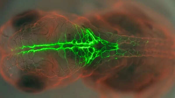 PRICKLE1 protein study uses glowing embryos to understand birth defects
