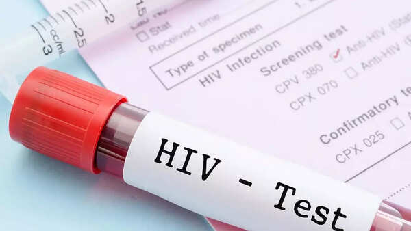 'Everyone stopped speaking to us': 10-year-old UP boy takes mother’s body alone for autopsy after HIV death; police arrange last rites
