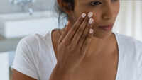 Beauty tips to deal with blackheads 