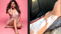 Hina Khan burns her hand while shooting 