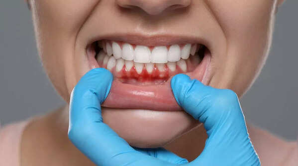 Dental problems