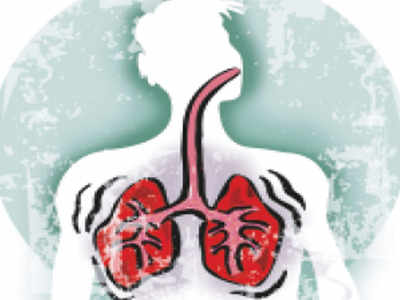 Acute infection could trigger chronic lung illness among recovered patients