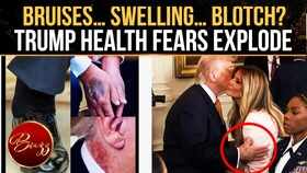 Donald Trump Health Buzz Explodes After Viral Hand Photos