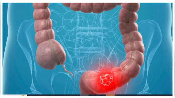 Abdominal Discomfort or Pain
