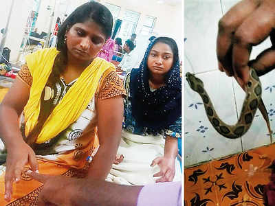 Bitten by snake, Dharavi woman carries it to Sion hospital to ‘help’ doctors choose anti-venom