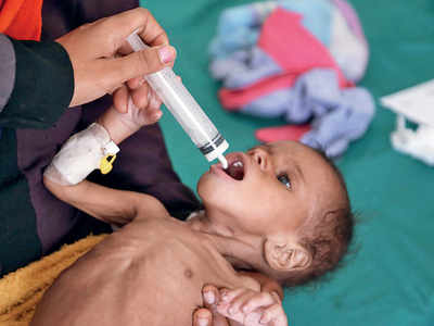 ‘85,000 children may have died of hunger in Yemen’