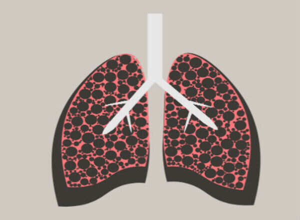 World Tuberculosis Day: The 3 most common Indian myths about TB!