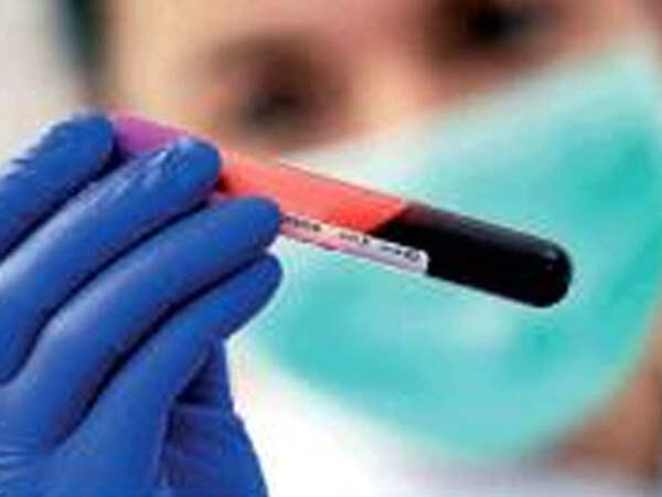 Aurangabad sees more cases, recoveries too