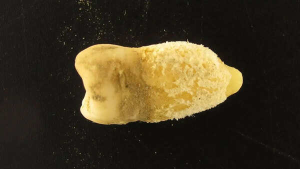 700-year-old Bolivian mummy tooth reveals scarlet fever bacterium before Europeans arrived