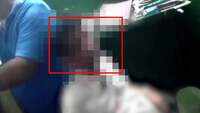 Doctor allegedly beaten to death by tea garden workers in Assam’s Jorhat 